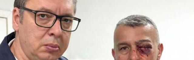 BOLjŠEVIČKI PLENUMAŠI UDARILI SU GA U OKO ISPRED: Vučić obišao povređenog policajca