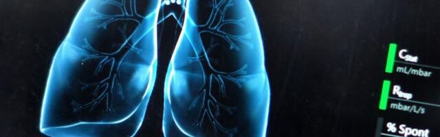 48 sati bez pluća: Veštački organ održao čoveka u životu do transplantacije