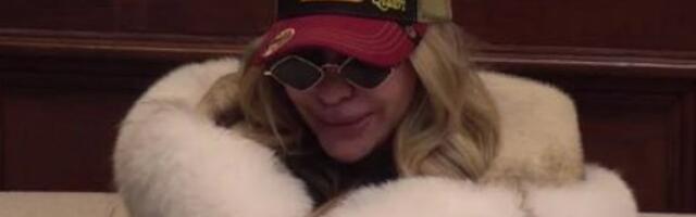 NAJNOVIJE VESTI O STANJU ANELI AHMIĆ: Lice u STRAVIČNOM stanju, rane mogu da se INFICIRAJU! (FOTO)