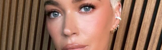 RIJALITI ZVEZDA OTKRILA POTRESNE DETALJE: Bori se sa RAKOM KOŽE - podelila svoje najteže trenutke sa fanovima! (FOTO)