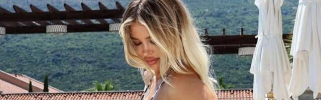 Poznata manekenka pretukla drugaricu: "Uhvatila me je za kosu, mislila sam da će..."