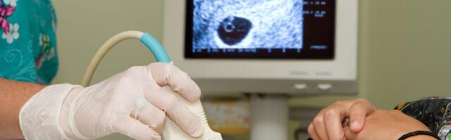 Saznala sam da sam trudna tek u 36. nedelji: Nisam imala nijedan simptom, ni stomak ni mučnine