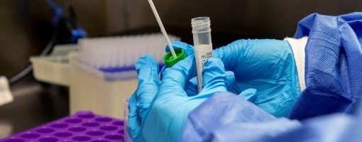 U Hrvatskoj 1.413 novozaraženih, umrlo 18 osoba