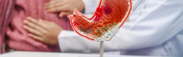 Gastroenterolog upozorava: Ovih pet ranih simptoma raka želuca ljudi najčešće ignorišu