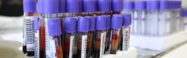 U Subotici još dvoje obolelo od HIV: Evo kako možete da se testirate