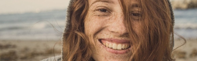 Izbelite svoje pegice jednostavnom metodom