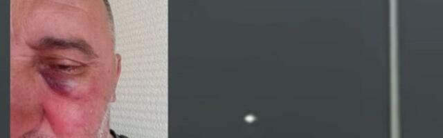 Skandal u komšiluku, Sloga objavila strašne slike: "Fudbaleri Željezničara pretukli su našeg fotografa"