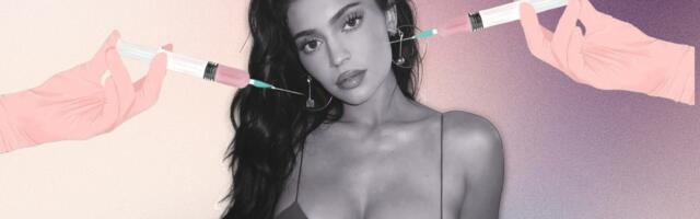 Da li je transparentnost je u trendu (kada su u pitanju estetske operacije poznatih)?