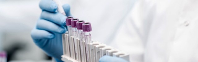 Na Kosovu preminulo 10, pozitivno 707 osoba