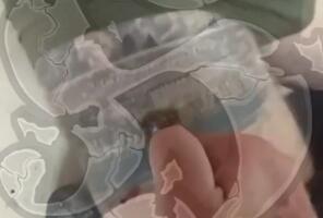 NAVIJAČU PALILI TETOVAŽU TORCIDE NA BUTINI! Uznemirujući snimak širi se na društvenim mrežama: "Ovo će ovde ostati crno, jer ti si jedno crno" (VIDEO)