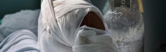 UŽAS U BATAJNICI: Plin počeo da curi, majka i sin pokušali da ugase plamen pa zadobili TEŠKE OPEKOTINE