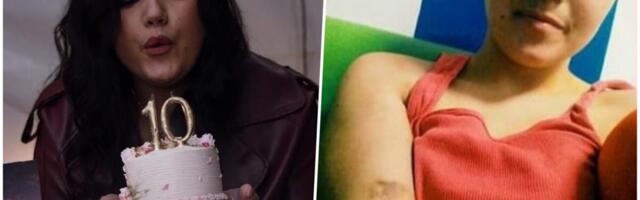 "Lečili su me od išijasa, a imala sam tumor": Ivana pobedila rak butne kosti posle 8 operacija, 30 zračenja, 14 hemioterapija i 2 sepse (foto)
