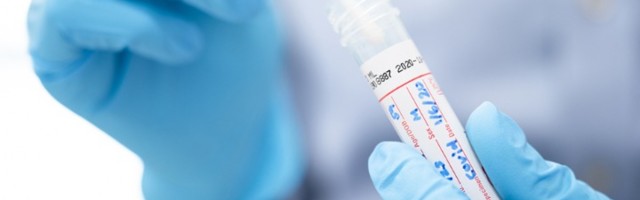 Više od 200 novozaraženih, preminuo jedan pacijent