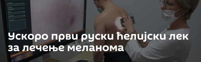 Ускоро први руски ћелијски лек за лечење меланома