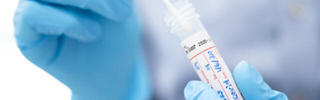 Preminula 41 osoba, pada broj novozaraženih