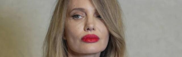 Novo lice, stare dileme:  Da li se Anđelina Džoli bori sa posledicama stresa, bolesti ili estetskih zahvata?